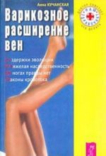 Варикозное расширение вен.