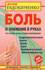 Боль и онемение в руках. Что нужно знать о своем заболевании