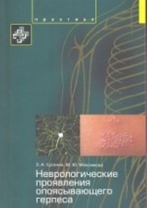 Nevrologicheskie projavlenija opojasyvajuschego gerpesa. Posobie dlja vrachej