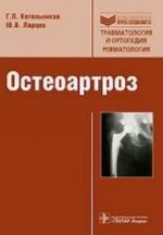 Osteoartroz.