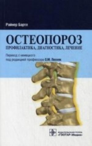 Osteoporoz