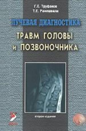 Luchevaja diagnostika travm golovy i pozvonochnika