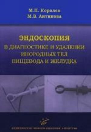 Эндоскопия в диагностике и удалении инородных тел пищевода и желудка