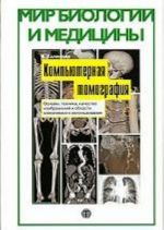 Kompjuternaja tomografija. Osnovy, tekhnika, kachestvo izobrazhenij i oblasti klinicheskogo ispolzovanija