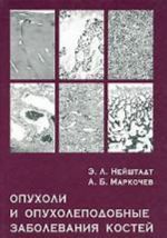 Опухоли и опухолеподобные заболевания костей