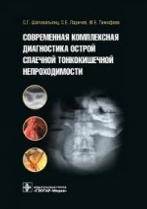 Sovremennaja kompleksnaja diagnostika ostroj spaechnoj tonkokishechnoj neprokhodimosti. Shapovaljants S. G