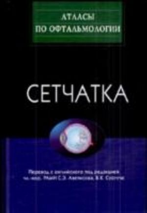 Setchatka