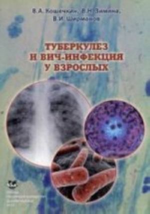 Tuberkulez i VICh-infektsija u vzroslykh: uchebnoe posobie