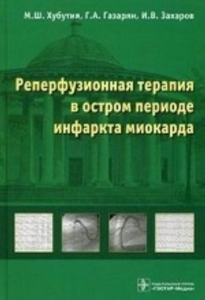 Реперфузионная терапия в остром периоде инфаркта миокарда.