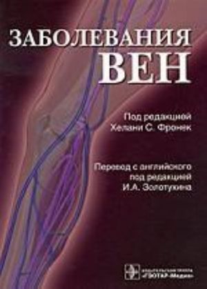 Заболевания вен.