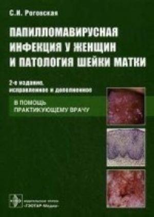 Papillomavirusnaja infektsija u zhenschin i patologija shejki matki. V pomosch praktikujuschemu vrachu