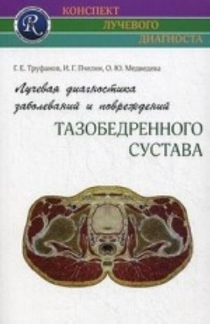 Luchevaja diagnostika zabolevanij i povrezhdenij tazobedrennogo sustava