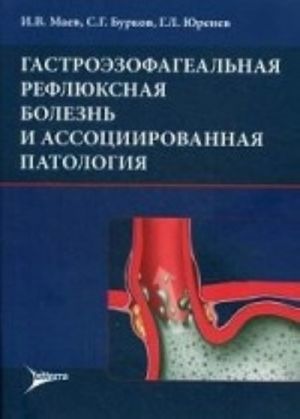 Гастроэзофагеальная рефлюксная болезнь и ассоциированная патология. Маев И. В., Бурков с. Г., Юренев Г. Л