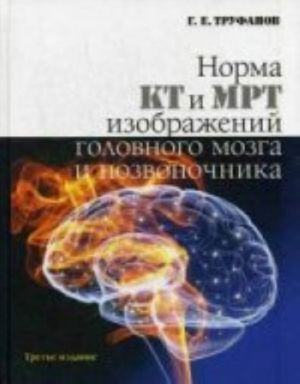 Norma KT i MRT izobrazhenij golovnogo mozga i pozvonochnika (Atlas izobrazhenij). 3-e izd