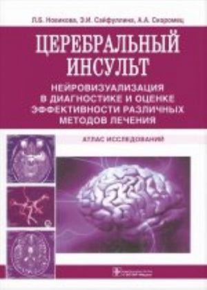 Церебральный инсульт. Нейровизуализация в диагностике и оценке эффективности различных методов лечения. Атлас исследований