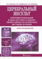 Tserebralnyj insult. Nejrovizualizatsija v diagnostike i otsenke effektivnosti razlichnykh metodov lechenija. Atlas issledovanij