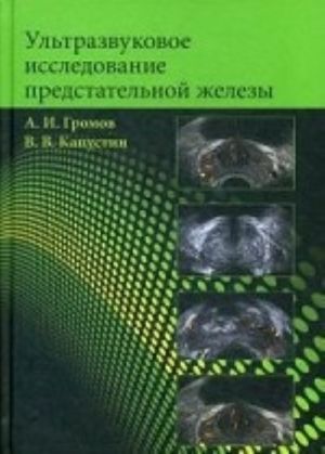 Ultrazvukovoe issledovanie predstatelnoj zhelezy