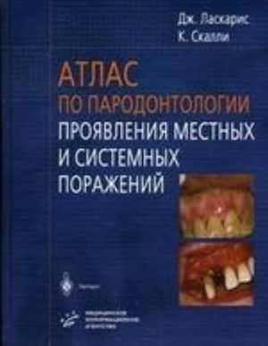 Атлас по пародонтологии. Проявления местных и системных поражений