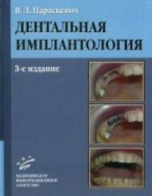 Dentalnaja implantologija. Osnovy teorii i praktiki