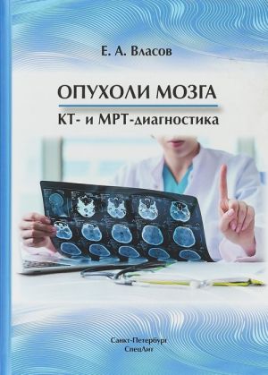 Opukholi mozga  KT- i MRT- diagnostika