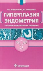 Giperplazija endometrija