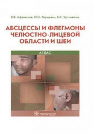 Абсцессы и флегмоны челюстно-лицевой области и шеи. Атлас: учебное пособие