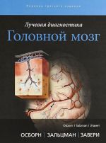 Лучевая диагностика. Головной мозг