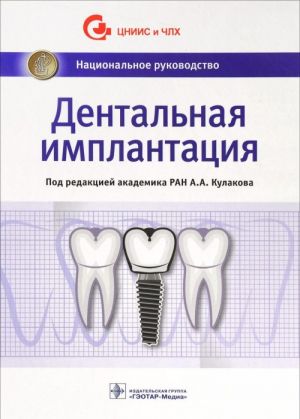 Dentalnaja implantatsija