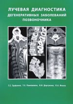 Luchevaja diagnostika. Degenerativnykh zabolevanij pozvonochnika