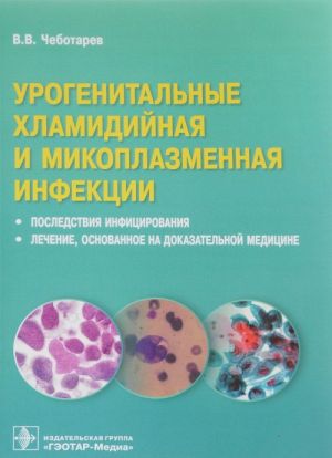 Урогенитальные хламидийная и микоплазменная инфекции.Последствия инфицирвания