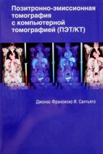 Позитронно-эмиссионная томография с компьютерной томографией