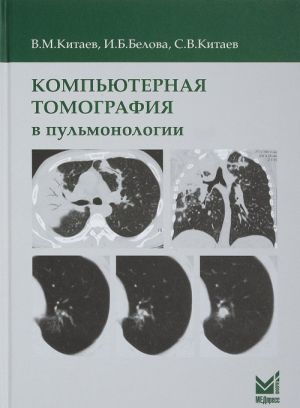 Компьютерная томография в пульмонологии