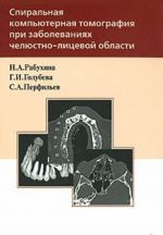 Spiralnaja kompjuternaja tomografija pri zabolevanijakh cheljustno-litsevoj oblasti