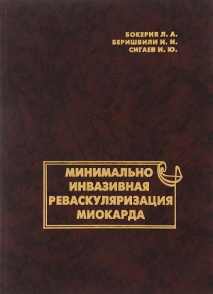 Минимально инвазивная реваскуляризация миокарда