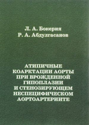 Atipichnye koarktatsii aorty pri vrozhdennoj gipoplazii i stenozirujuschem nespetsificheskom aortoarteriite