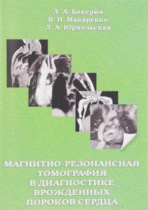 Магнитно-резонансная томография в диагностике врожденных пороков сердца