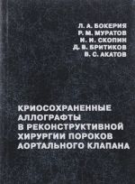 Kriosokhranennye allografty v rekonstruktivnoj khirurgii porokov aortalnogo klapana