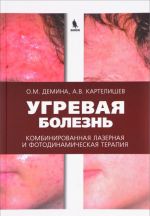 Ugrevaja bolezn. Kombinirovannaja lazernaja i fotodinamicheskaja terapija. Rukovodstvo dlja vrachej