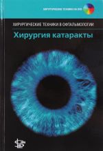 Khirurgija katarakty (+ DVD)