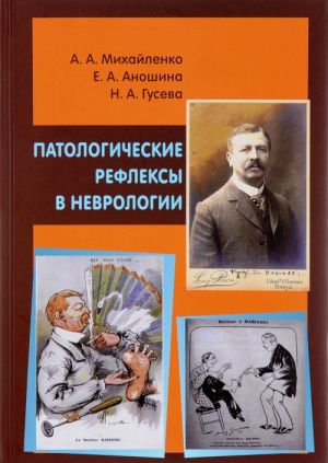 Патологические рефлексы в неврологии