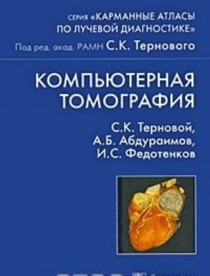 Компьютерная томография