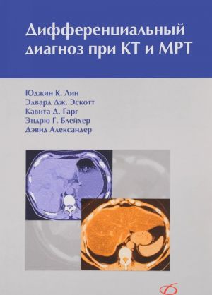 Differentsialnyj diagnoz pri KT i MRT