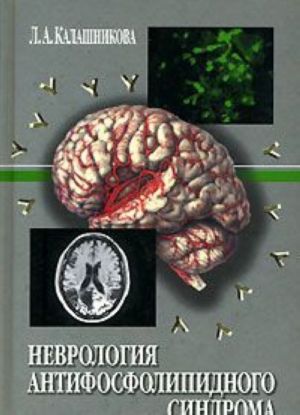 Nevrologija antifosfolipidnogo sindroma