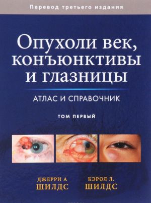 Опухоли век, конъюнктивы и глазницы. Атлас и справочник. В 2 томах. Том 1