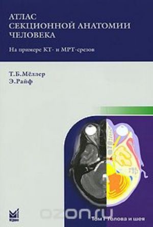 Atlas sektsionnoj anatomii cheloveka na primere KT- i MRT-srezov. V 3 tomakh. Tom 1. Golova i sheja