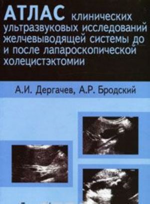 Atlas klinicheskikh ultrazvukovykh issledovanij zhelchevyvodjaschej sistemy do i posle laparoskopicheskoj kholetsistektomii