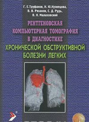 Rentgenovskaja kompjuternaja tomografija v diagnostike khronicheskoj obstruktivnoj bolezni legkikh