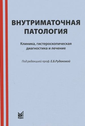 Vnutrimatochnaja patologija. Klinika, gisteroskopicheskaja diagnostika i lechenie