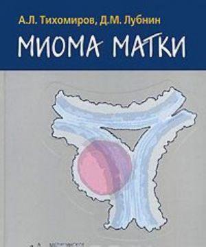 Mioma matki