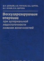 Vaskuljarizirujuschie operatsii pri arterialnoj nedostatochnosti nizhnikh konechnostej